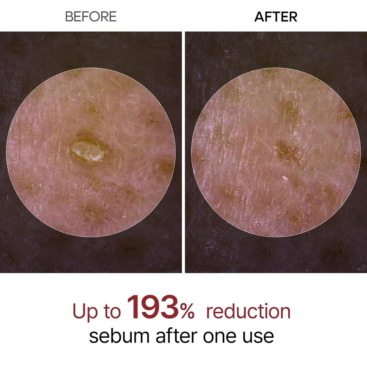 Dr. Melaxin Peel Shot Glow Black Rice Peeling Ampoule - 80 ml - Lahab Beauty | لهب بيوتي