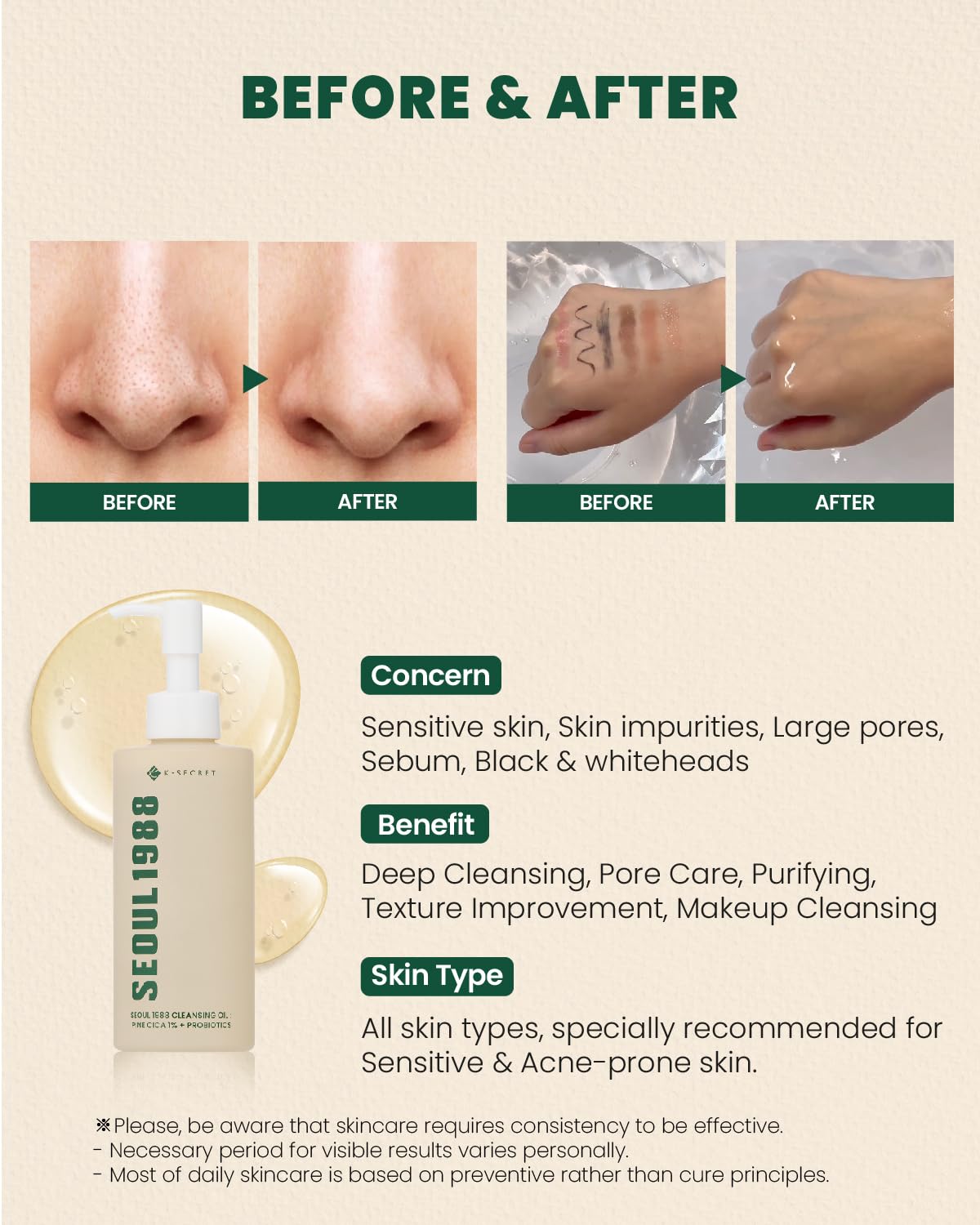 K-SECRET Seoul 1988 Cleansing Oil – Pine Cica 1% + Probiotics | 200ml - Lahab Beauty | لهب بيوتي