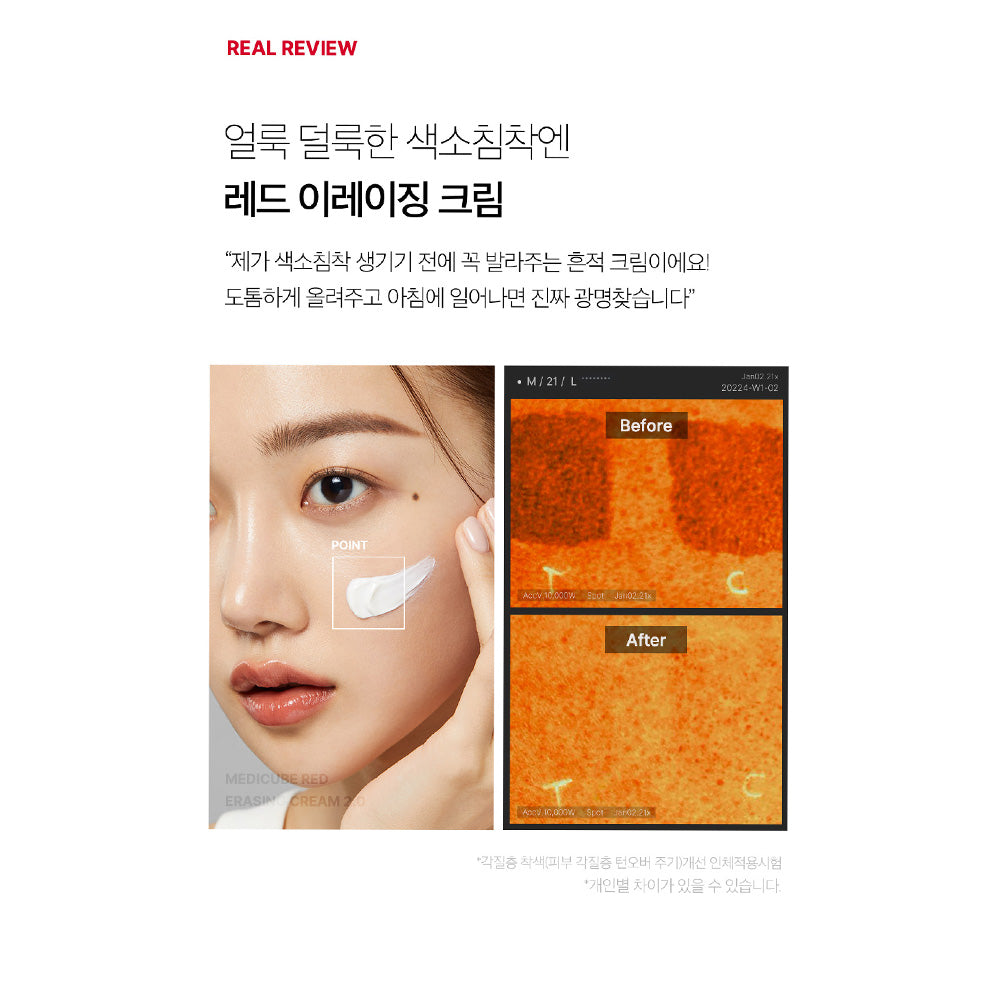 MEDICUBE – Red Erasing Cream 2.0 | 100ml - Lahab Beauty | لهب بيوتي