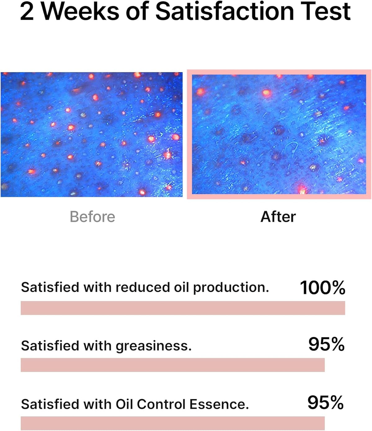 [Celimax] Oil Control Capsule Essence - Lahab Beauty | لهب بيوتي