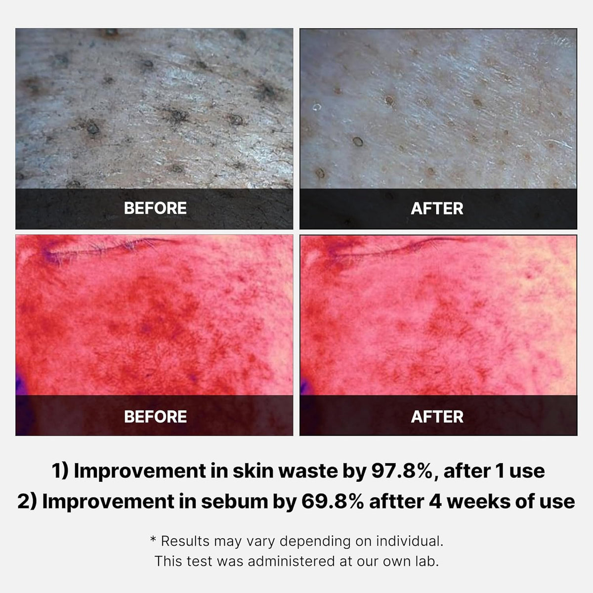 Medicube Swipe & Spray Red duo for Troubled Skin - Lahab Beauty | لهب بيوتي