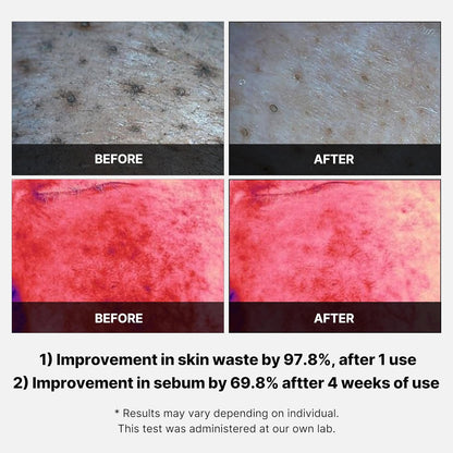 Medicube Swipe & Spray Red duo for Troubled Skin - Lahab Beauty | لهب بيوتي