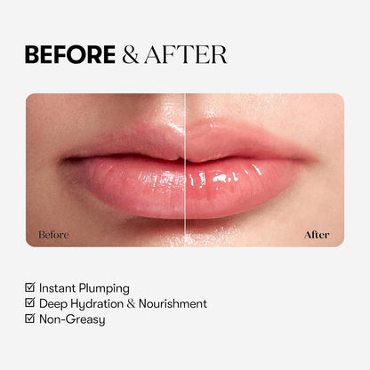 [VT COSMETICS] REEDLE SHOT LIP PLUMPER BEGINNER 0.15 oz (4.3 g) - Lahab Beauty | لهب بيوتي