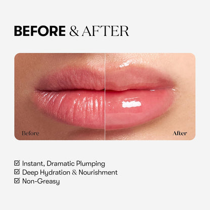 [VT COSMETICS] Reedle Shot Lip Plumper (Expert) 0.15 oz (4.3 g) - Lahab Beauty | لهب بيوتي
