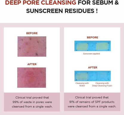 [SKIN 1004] Poremizing Deep Cleansing Foam - 125ml - Lahab Beauty | لهب بيوتي