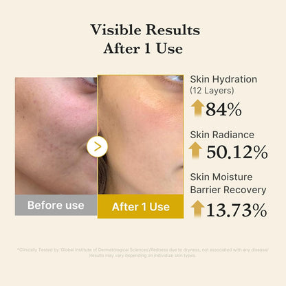 Medicube Turmeric Vitamin Gold Jelly Mist Serum - 100ml - Lahab Beauty | لهب بيوتي