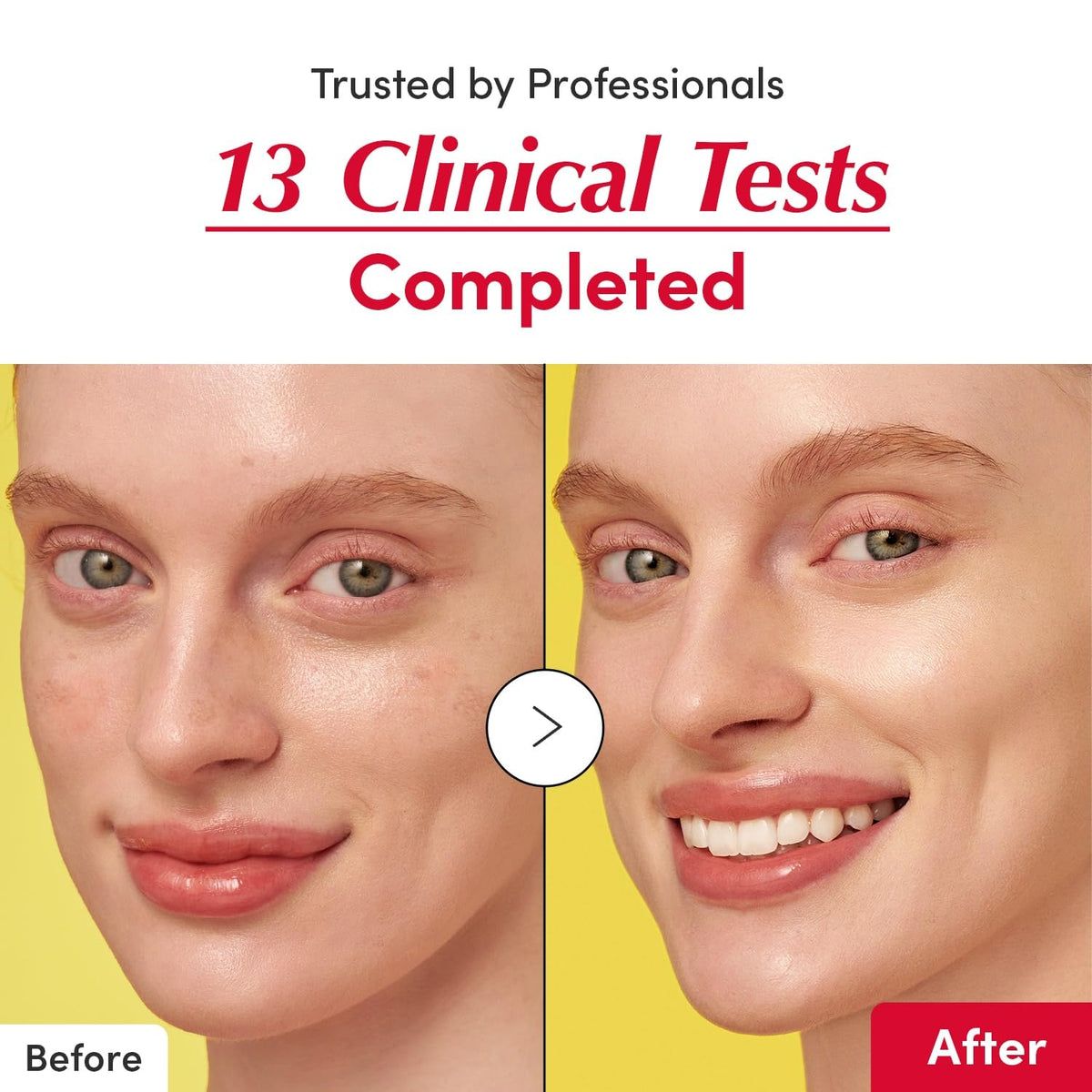 EQQUALBERRY Vitamin C Serum & Toner Set - Lahab Beauty | لهب بيوتي