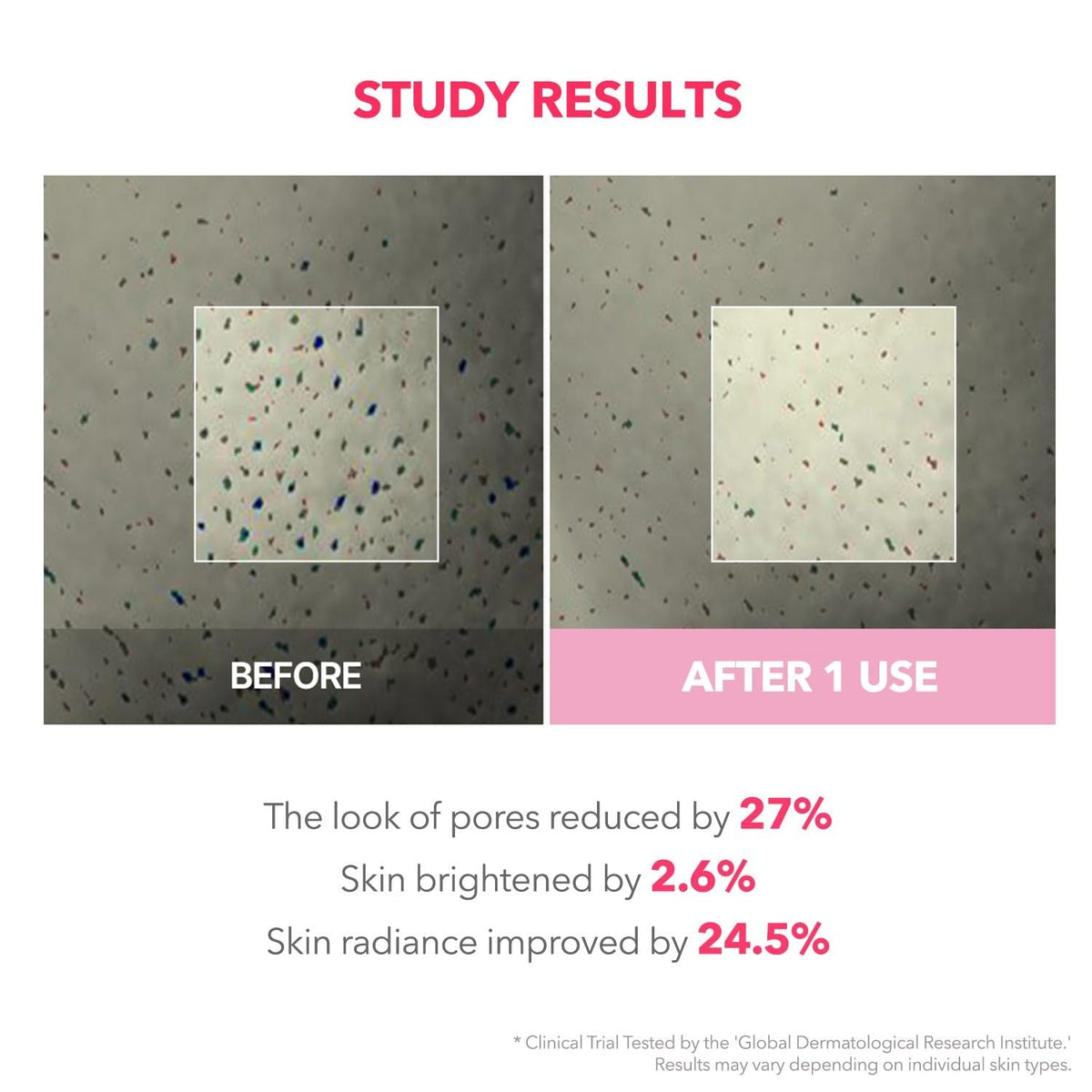 APRILSKIN TXA Niacinamide 99 Overnight Wrapping Mask - 80ml - Lahab Beauty | لهب بيوتي