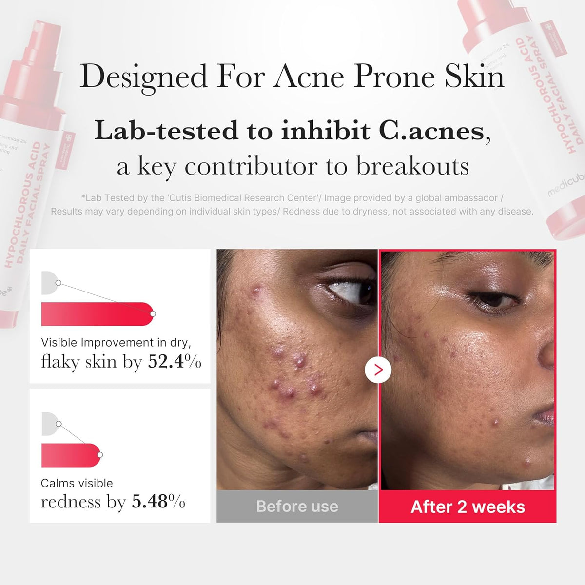 Medicube Swipe & Spray Red duo for Troubled Skin - Lahab Beauty | لهب بيوتي