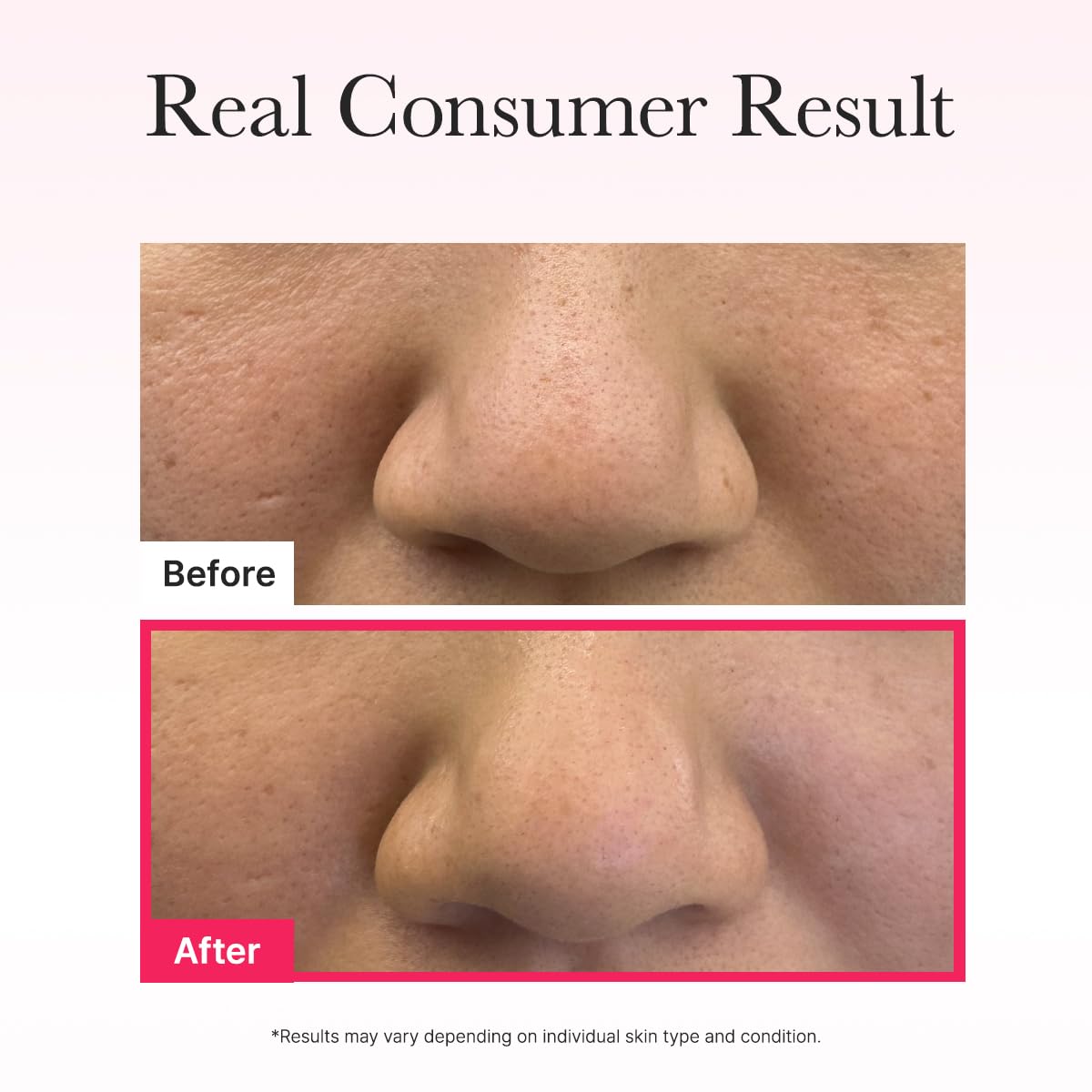 ARENCIA Red Collagen Jello Mask – Plump & Hydrating Overnight Hydrogel Mask (4ea) ❤️✨ - Lahab Beauty | لهب بيوتي