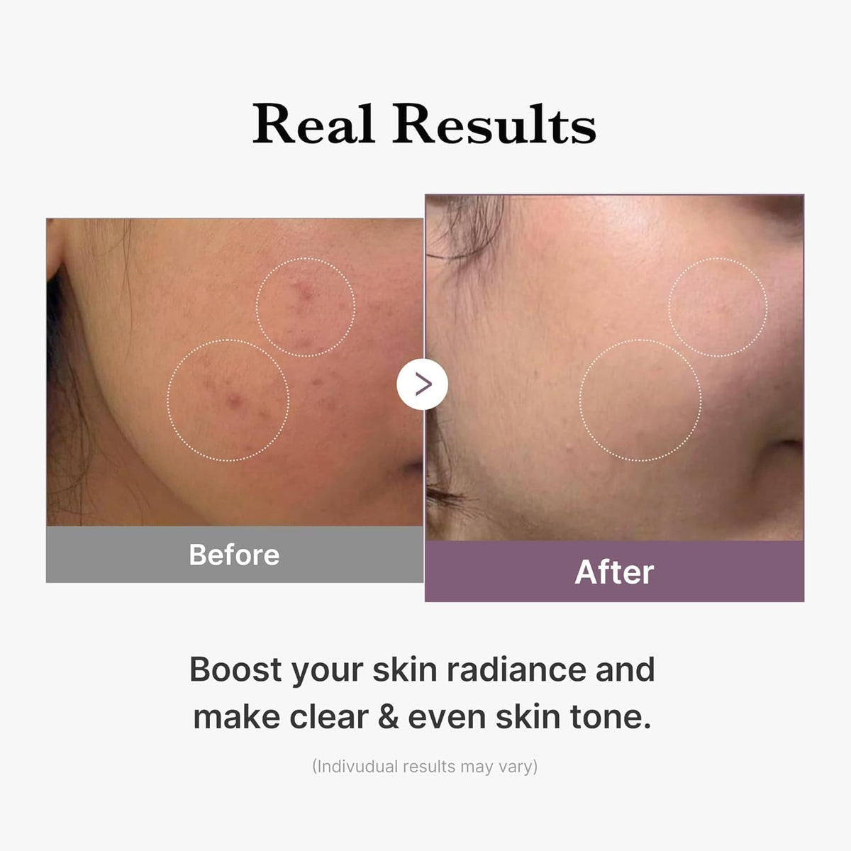 Medicube – Age-R Glutathione Glow Toner | 140ml - Lahab Beauty | لهب بيوتي