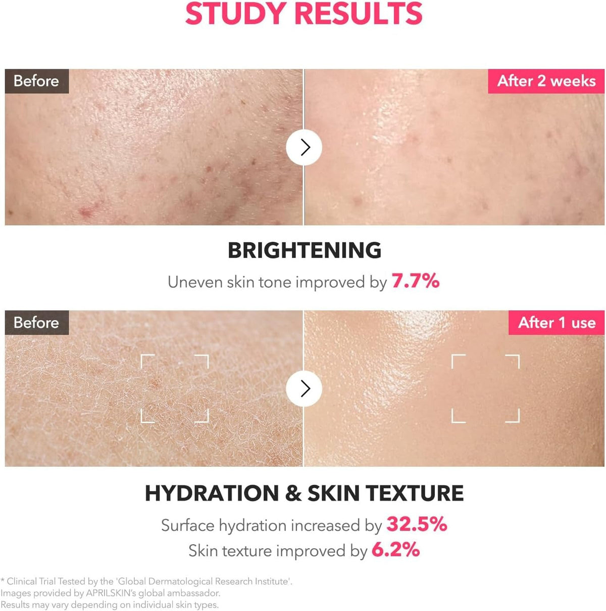 APRILSKIN TXA + Niacinamide 99 Pink Milky Toner -  150ml - Lahab Beauty | لهب بيوتي