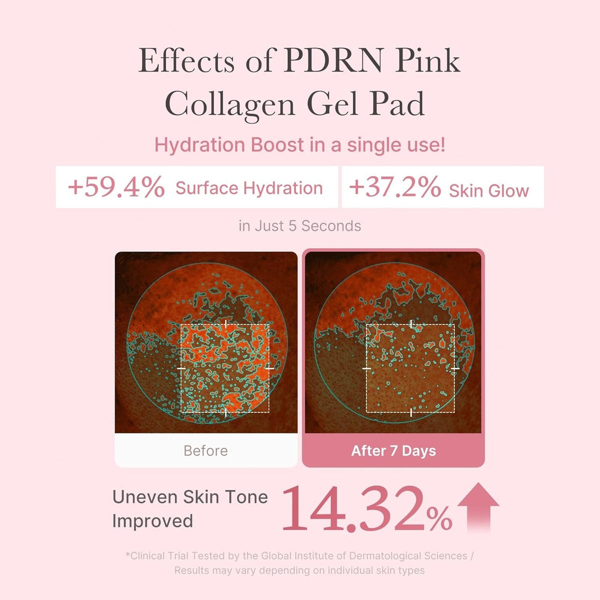 Medicube PDRN Pink Collagen Toning Gel Toner Pad - 70 pads - Lahab Beauty | لهب بيوتي