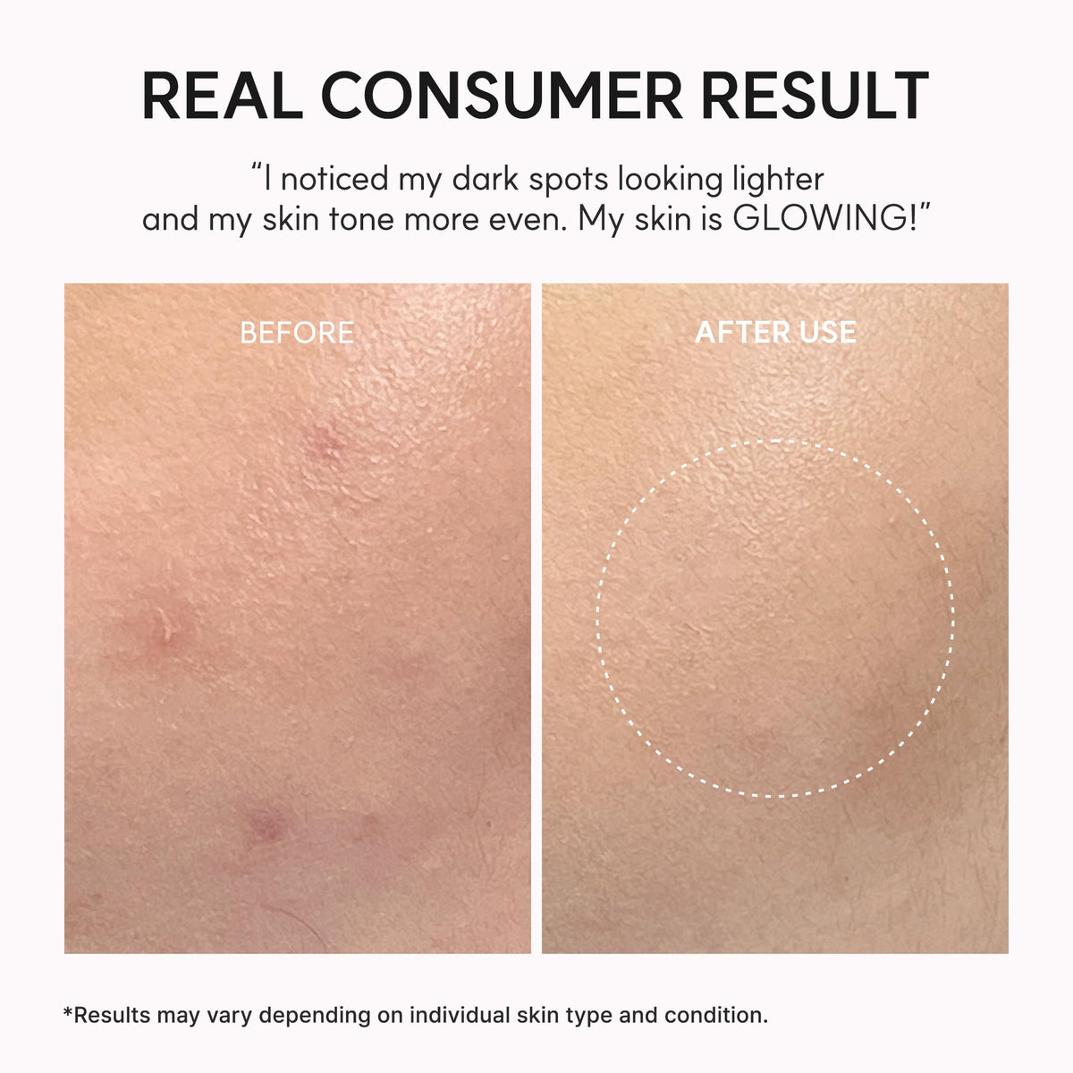 Arencia NAD+ Serum Booster Shot 30ml - Lahab Beauty | لهب بيوتي