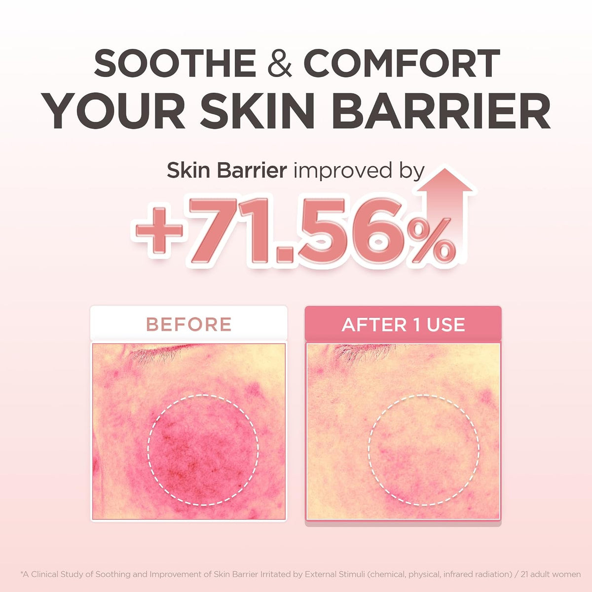 SKIN1004 Madagascar Centella PDRN 1.5% Cream 30ml - Lahab Beauty | لهب بيوتي