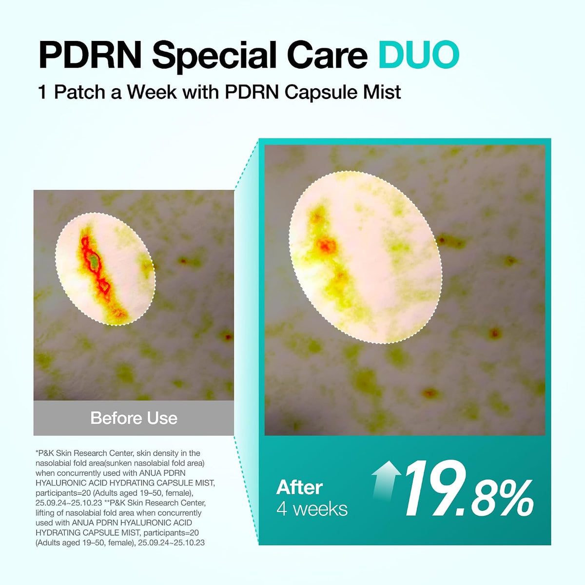 Anua PDRN Collagen Melting Patch For Glass Skin (4 Patches) - Lahab Beauty | لهب بيوتي