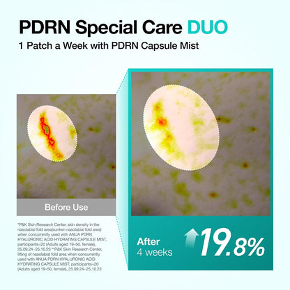 Anua PDRN Collagen Melting Patch For Glass Skin (4 Patches) - Lahab Beauty | لهب بيوتي
