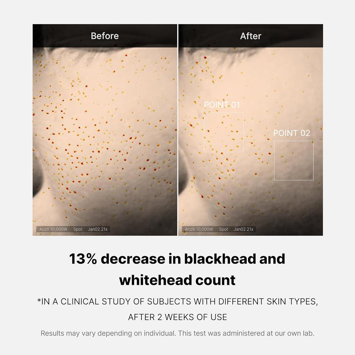 [Medicube] Zero Pore One-day Serum 30ml - Lahab Beauty | لهب بيوتي