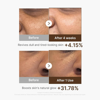Medicube Deep Vita C Capsule Serum & Cream Duo - Lahab Beauty | لهب بيوتي