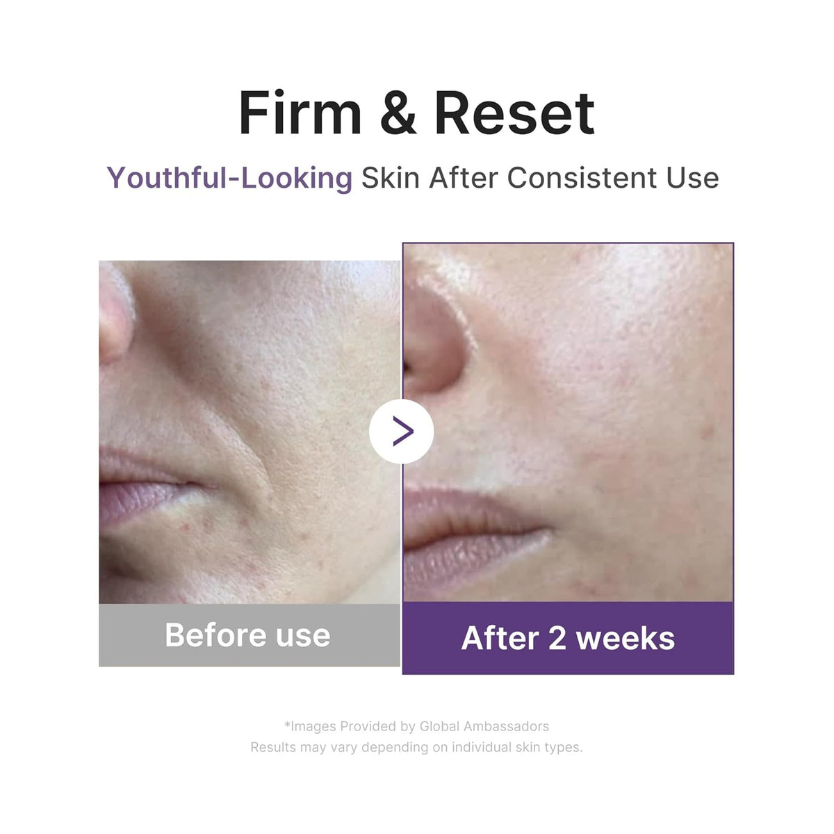 MEDICUBE Pore Refine & Retinol Boosting Serum Duo - Lahab Beauty | لهب بيوتي