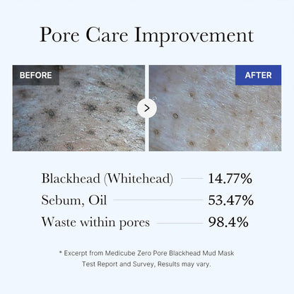 Medicube Zero Pore Blackhead Mud Facial Mask - Lahab Beauty | لهب بيوتي