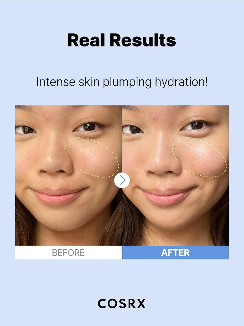 COSRX The Hyaluronic Acid 3 Serum – Deep Hydration for Plump, Supple Skin - Lahab Beauty | لهب بيوتي