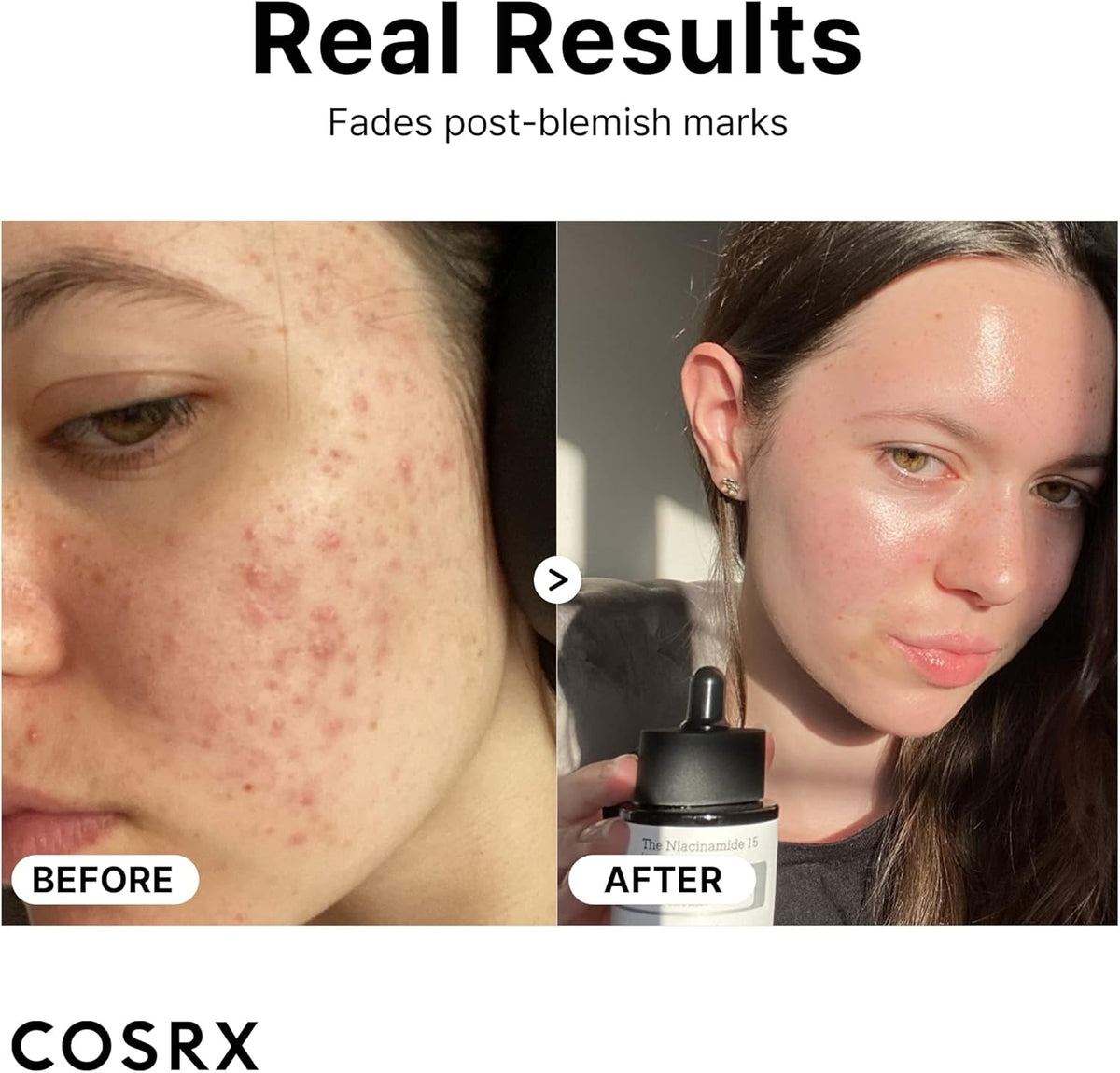 [Cosrx] The Niacinamide 15 Serum 20ml - Lahab Beauty | لهب بيوتي