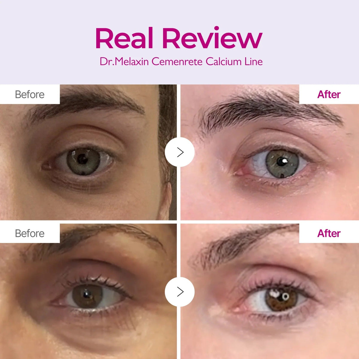 Dr. Melaxin Cemenrete Calcium Eyecare Routine - Lahab Beauty | لهب بيوتي