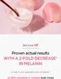 [Anua] Peach 70% Niacinamide Serum - 30ml - Lahab Beauty | لهب بيوتي