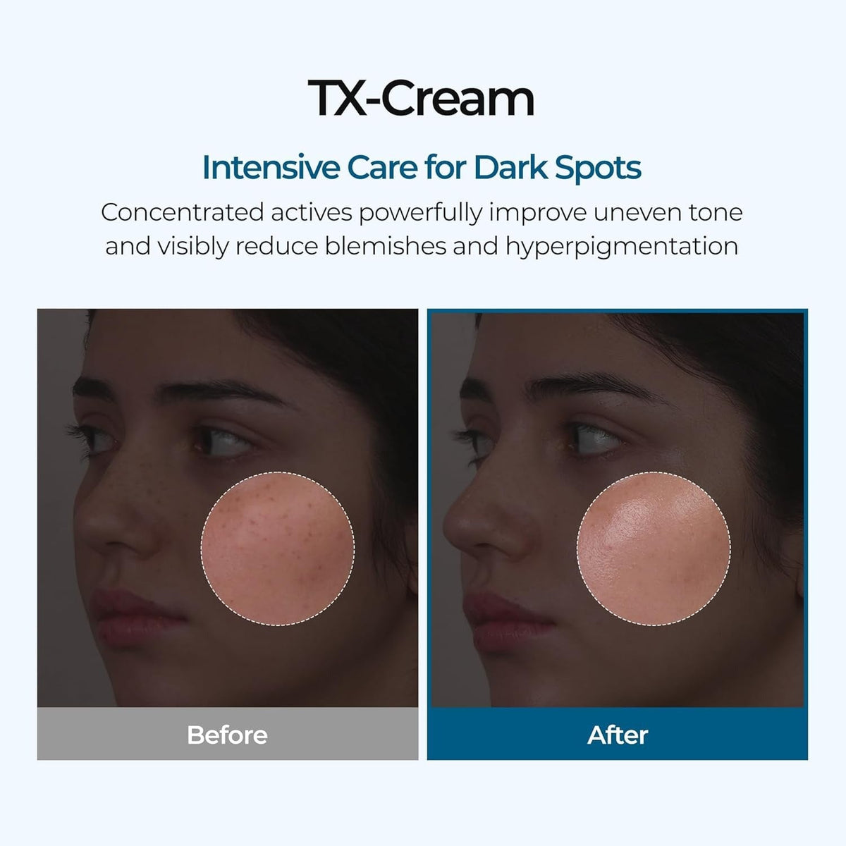 DR.Melaxin TX Tranexamic Acid Cream - 50 ml - Lahab Beauty | لهب بيوتي