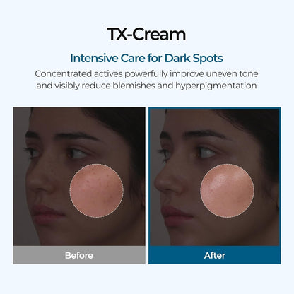 DR.Melaxin TX Tranexamic Acid Cream - 50 ml - Lahab Beauty | لهب بيوتي