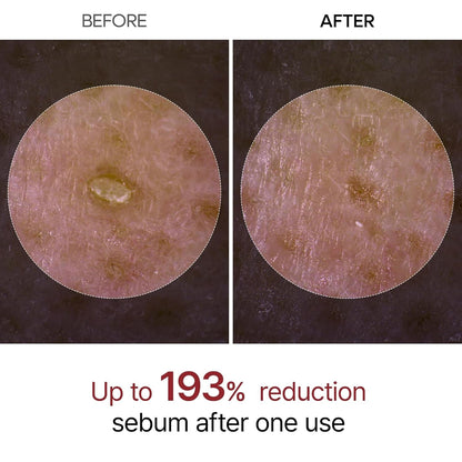 Dr. Melaxin Peel Shot Glow Black Rice Peeling Ampoule - 80 ml - Lahab Beauty | لهب بيوتي
